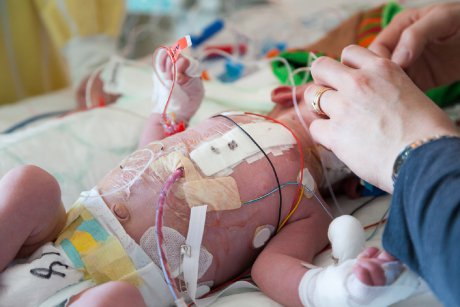 Povești de mamă: bebelușul meu a făcut un infarct înainte de a se naște