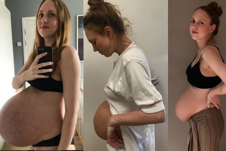 Cum arată corpul unei mame de tripleți înainte și după naștere? Fotografii sincere care dezvăluie adevărul