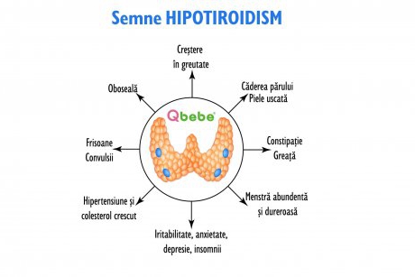 Semne că suferi de hipotiroidism