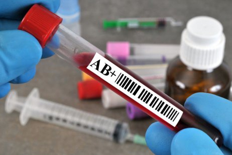 6 lucruri pe care trebuie să le știi dacă ai grupa de sânge AB IV