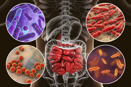 Studiu controversat: simptomele autismului pot fi reduse cu 50% cu transplantul de fecale