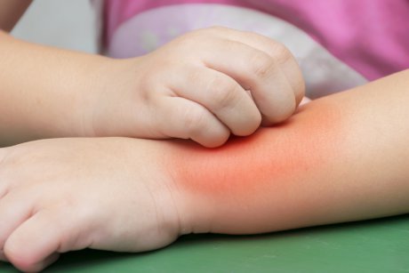 Ghid de la dermatolog: cum recunoști bolile de piele ale copilului