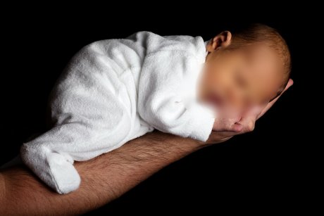 Medic suspendat după ce s-a născut un bebeluș fără chip. Cum a fost posibil așa ceva