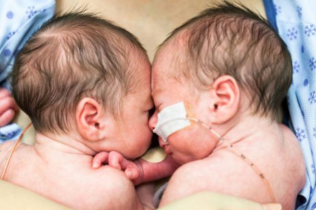 Ține-l în viață: Povestea celor doi frați care au fost salvați, pentru că s-au născut în maternitatea potrivită
