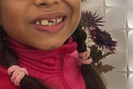 Fetița unei vedete de la noi, discriminată de colegi. „I-au spart un dinte: O să fac plângere la Ministru”