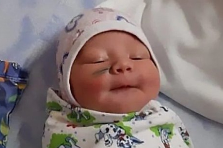Îngrozitor! Un nou-născut s-a ales pe viață cu o cicatrice, după ce medicii i-au tăiat obrazul în timpul cezarienei