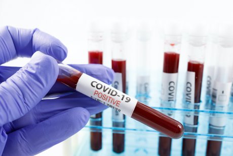 OMS confirmă: Testele pozitive de Covid-19 la pacienții vindecați nu sunt reinfectări
