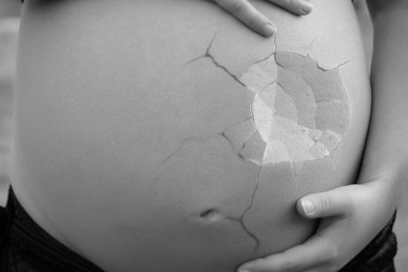 Avortul spontan se elimină singur? Ce ne spune specialistul