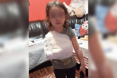 Alt caz scandalos la spitalul din Corabia: un medic a bandajat mâna unei fetițe de 4 ani peste tricou