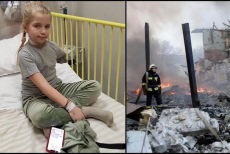 Povestea Sashei, fetița care și-a pierdut brațul în bombardamentele din Kiev: "Nu știu de ce m-au împușcat rușii. Sper că a fost din greșeală"