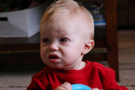 Secreție galbenă la ochi la bebeluș: cauze și tratament