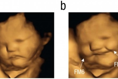 Studiu incredibil: imagini cu bebeluși în uter care reacționează la gustul amar al alimentelor mâncate de mama