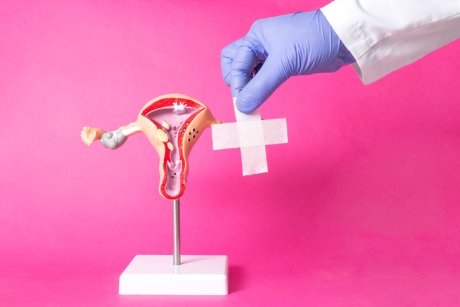 Totul despre histeroscopia diagnostică și intervențională