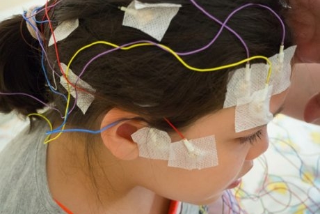 Epilepsia, una dintre cele mai frecvente boli neurologice la copii. Care sunt semnele