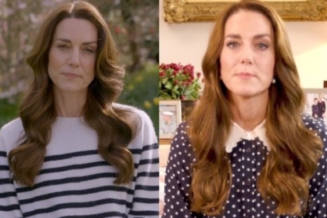 Ce este chimioterapia preventivă, tratamentul pe care îl urmează în prezent Kate Middleton