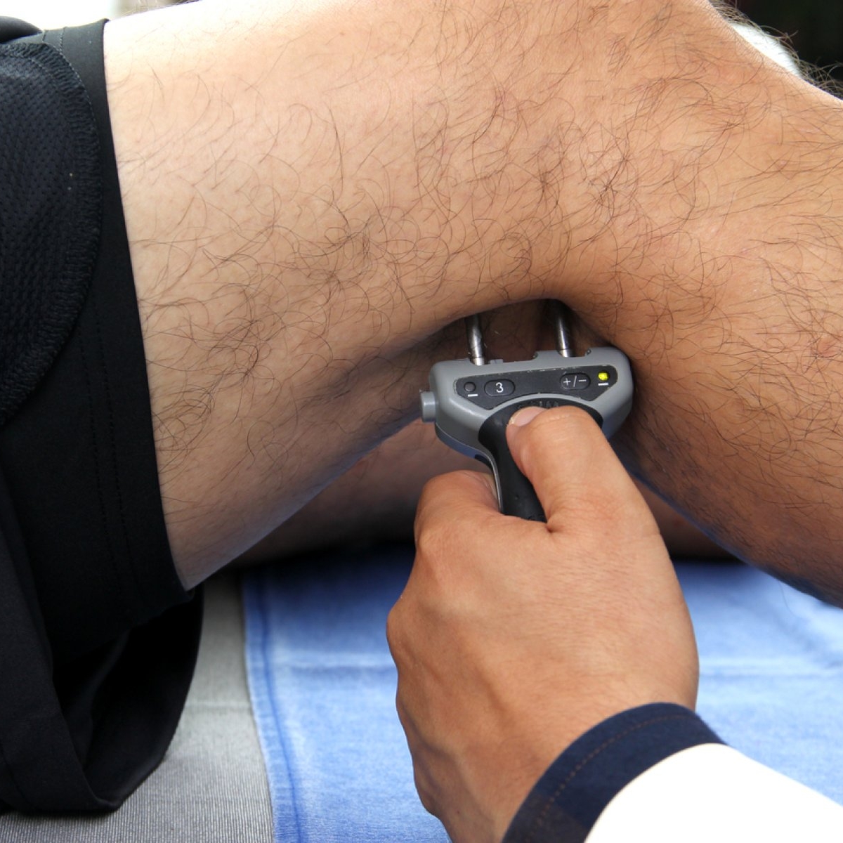 Electromiografie: ce este și când este recomandată?