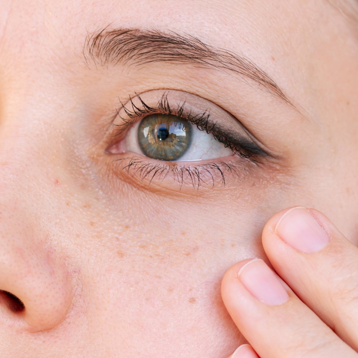 Acid kojic: beneficii și mod de utilizare