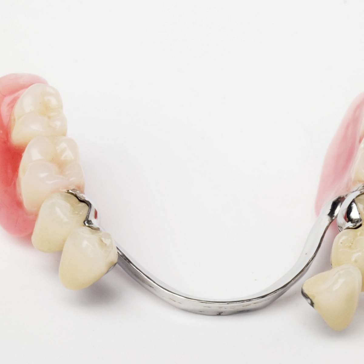 Cum sa alegi bontul protetic potrivit pentru fiecare caz? X sfaturi si recomandari