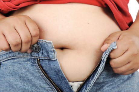 Obezitatea la copii: preventie, cauze, tratament