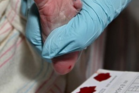 Totul despre testul de sange din calcaiul bebelusului
