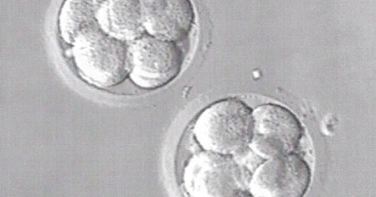 Dupa tratamentele de fertilizare, sotia mea a ramas insarcinata cu tripleti, dar a vrut sa avorteze doi dintre ei
