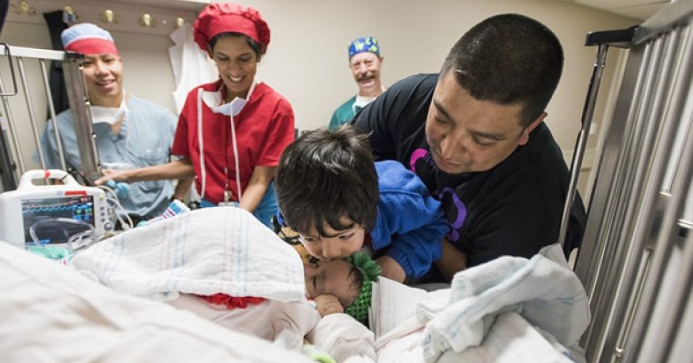 Operatie de separare a doua fetite siameze la un spital american 