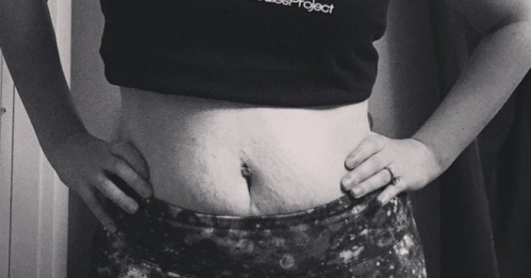 Noul trend pe Instagram: Mamicile isi arata mandre cicatricile postpartum
