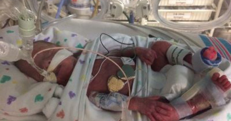 Un bebelus nascut la 23 de saptamani pe un vas de croaziera supravietuieste, dar se pun probleme legate de asa-numita "luna de miere" a bebelusilor