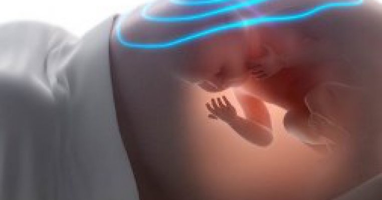 Va putea tehnologia de imprimare 3D sa inlocuiasca investigatiile cu ultrasunete din timpul sarcinii?