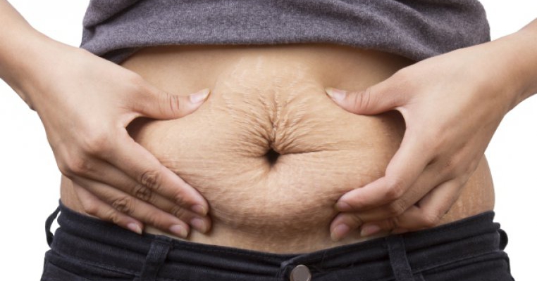 Corpul dupa nastere: 10 surprize postpartum