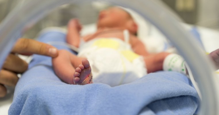 Doar 8 cazuri in lume: bebeluşul născut fără faţă la maternitatea din Botoşani