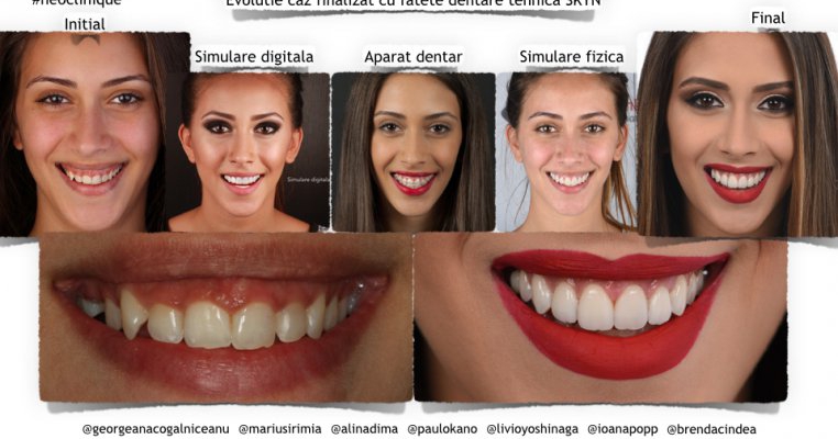 Estetică dentară în timp real, inovație stomatologică la Neoclinique