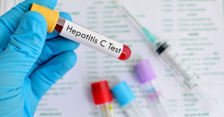 Tot ce trebuie să știi despre hepatita C