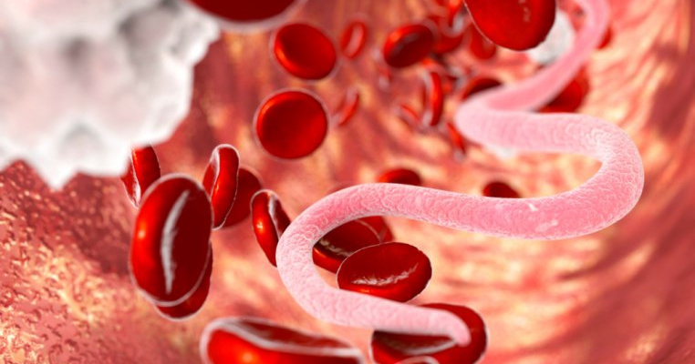 Toxocaroza la copii