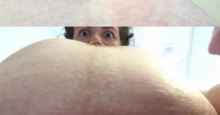 Așa arată burtica după cezariană! Fotografia sinceră a unei mame care a isterizat internetul