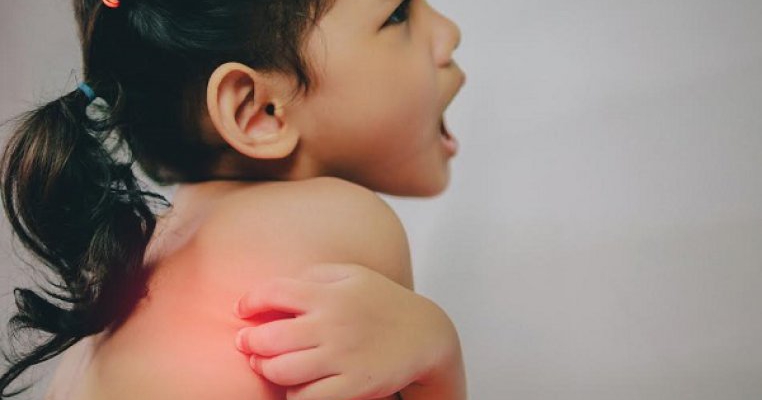 17 remedii naturale pentru arsurile solare ale copilului