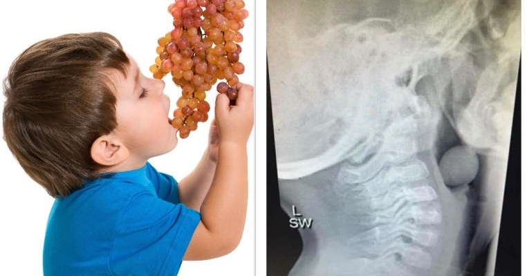 De ce nu trebuie să lăsăm copiii să mănânce struguri nesupravegheat? O radiografie terifiantă răspunde!