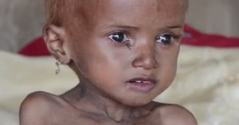 Holeră și foamete în Yemen! Copiii mor pe capete, mamele plâng!