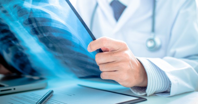 9 simptome de cancer osos la copil