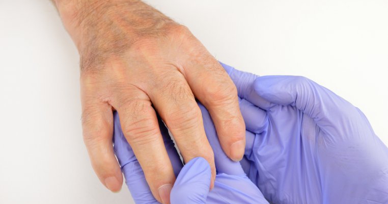 artrita măsoară degetul