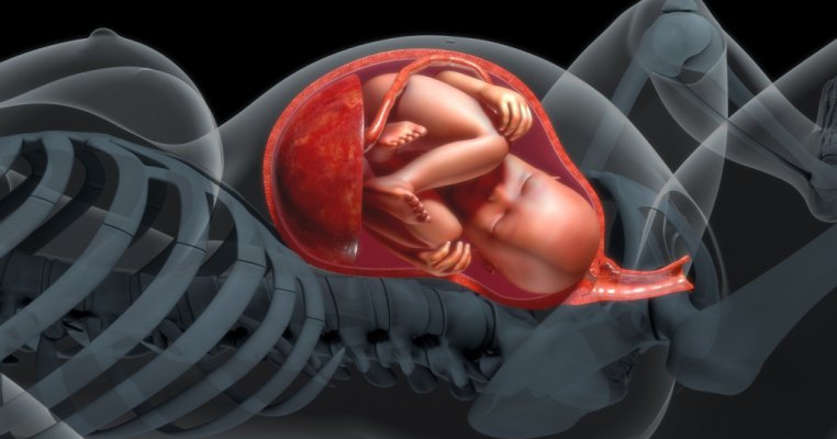 Placenta accreta: cauze și simptome