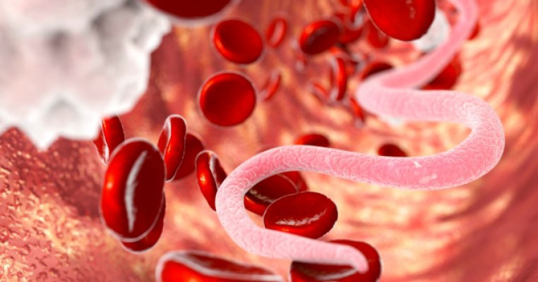 PARAZITI INTESTINALI. 10 semne ca ii ai in corp. Pe multe dintre ele le IGNORI!