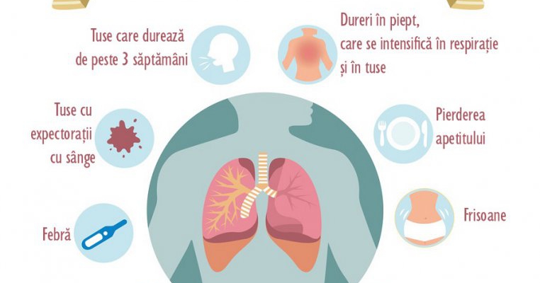 Semne că ai putea să ai tuberculoză