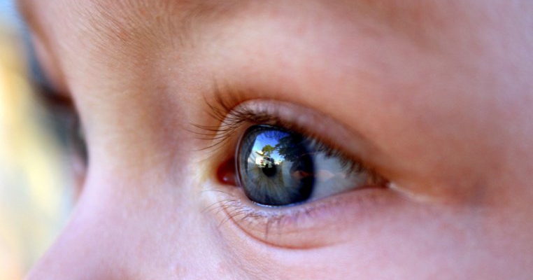 umflatura dureroasa sub ochi revizuirea cremei pentru ochi anti-îmbătrânire nuxe