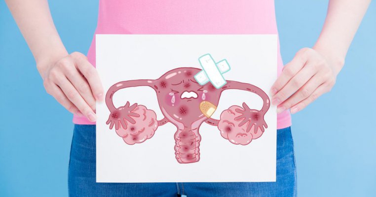 Chist ovarian. Ce este si cum se trateaza. Cat pot fi de periculoase niste chisturi ovariene