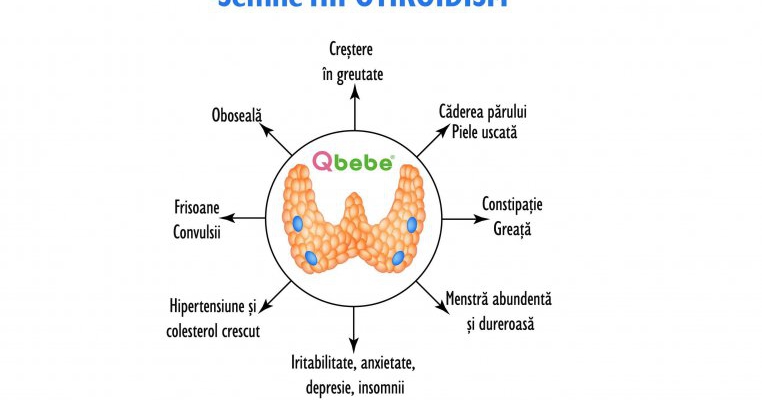 Semne că suferi de hipotiroidism