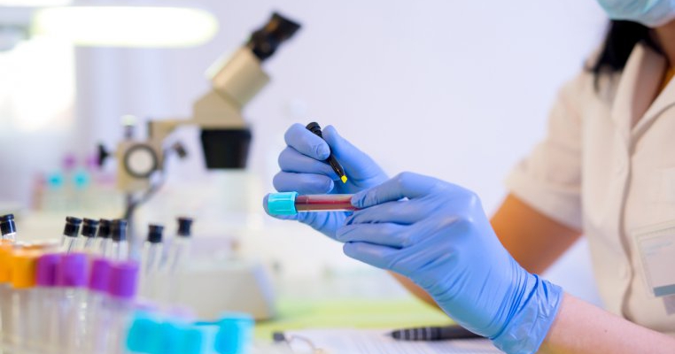 Șocant! 70% din cele 4.000 de laboratoare pentru analize nu au contract cu statul