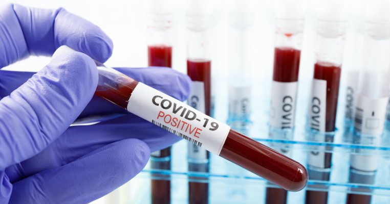 OMS confirmă: Testele pozitive de Covid-19 la pacienții vindecați nu sunt reinfectări