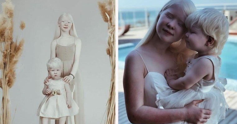 Nu ai văzut ceva mai frumos! Două surori albino șochează lumea cu fotografii spectaculoase