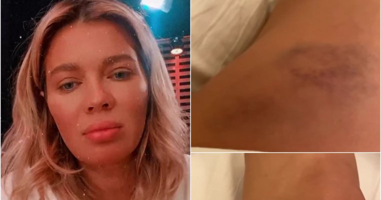 Gina Pistol și-a pus sarcina în pericol: „Am căzut rău! Mă doare de mor!”